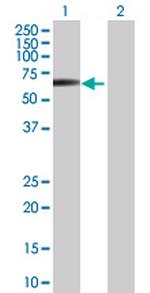 STK38L Antibody in Western Blot (WB)