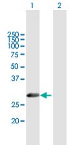 METAP1 Antibody in Western Blot (WB)