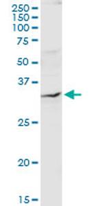 QPRT Antibody in Western Blot (WB)