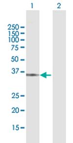 QPRT Antibody in Western Blot (WB)