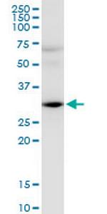 HEY2 Antibody in Western Blot (WB)