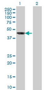 AIPL1 Antibody in Western Blot (WB)