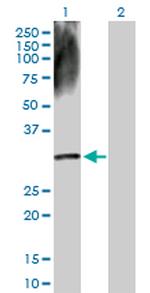 DECR2 Antibody in Western Blot (WB)