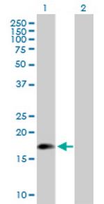 ARL5A Antibody in Western Blot (WB)