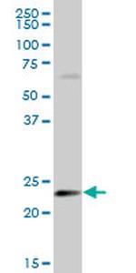 HSPB8 Antibody in Western Blot (WB)