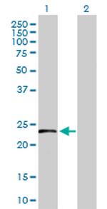 HSPB8 Antibody in Western Blot (WB)