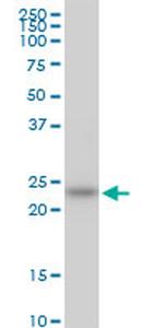 HSPB8 Antibody in Western Blot (WB)