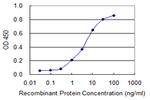 TIMM8B Antibody in ELISA (ELISA)