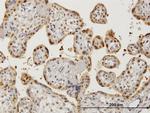 AATF Antibody in Immunohistochemistry (Paraffin) (IHC (P))