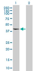 TAF5L Antibody in Western Blot (WB)