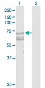 TNFRSF21 Antibody in Western Blot (WB)