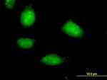 SESN1 Antibody in Immunocytochemistry (ICC/IF)