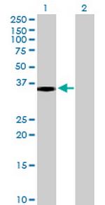 SULT1B1 Antibody in Western Blot (WB)