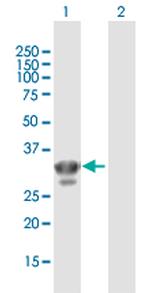 CHMP4A Antibody in Western Blot (WB)