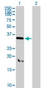 SNX11 Antibody in Western Blot (WB)