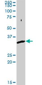 SNX11 Antibody in Western Blot (WB)