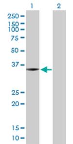 SNX11 Antibody in Western Blot (WB)