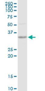 SNX11 Antibody in Western Blot (WB)