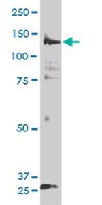 PIK3R4 Antibody in Western Blot (WB)