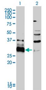 HDGFRP3 Antibody in Western Blot (WB)