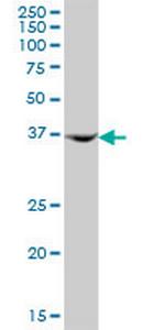 AMDHD2 Antibody in Western Blot (WB)