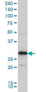 EXOSC3 Antibody in Western Blot (WB)