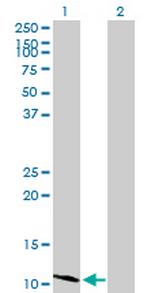 HSD17B12 Antibody in Western Blot (WB)