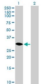 HSD17B14 Antibody in Western Blot (WB)