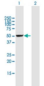 DDX47 Antibody in Western Blot (WB)