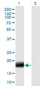 MARCH2 Antibody in Western Blot (WB)