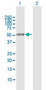 PLA1A Antibody in Western Blot (WB)