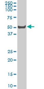 LW-1 Antibody in Western Blot (WB)