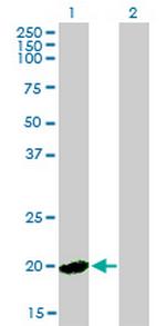 HPCAL4 Antibody in Western Blot (WB)