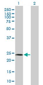 SPA17 Antibody in Western Blot (WB)