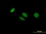 BTG4 Antibody in Immunocytochemistry (ICC/IF)