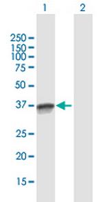 OCIAD1 Antibody in Western Blot (WB)