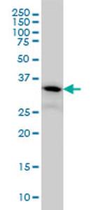 FLJ20643 Antibody in Western Blot (WB)