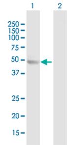 TTC38 Antibody in Western Blot (WB)