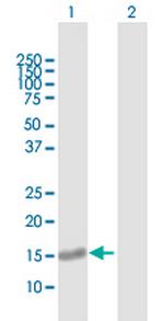 PLEKHJ1 Antibody in Western Blot (WB)