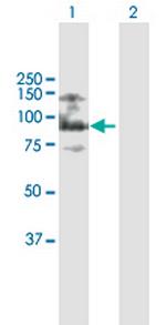 ASXL2 Antibody in Western Blot (WB)