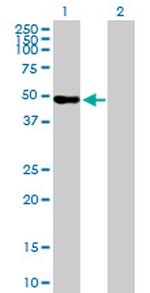 WDR41 Antibody in Western Blot (WB)