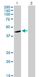 FLJ10986 Antibody in Western Blot (WB)