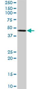 STYK1 Antibody in Western Blot (WB)