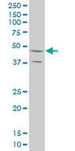 STYK1 Antibody in Western Blot (WB)