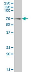 NPLOC4 Antibody in Western Blot (WB)