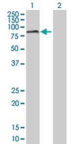 RIOK2 Antibody in Western Blot (WB)