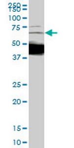 DCP1A Antibody in Western Blot (WB)