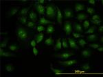 DCP1A Antibody in Immunocytochemistry (ICC/IF)