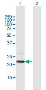 C19orf80 Antibody in Western Blot (WB)