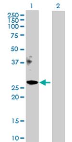 APOM Antibody in Western Blot (WB)